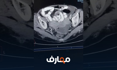 تشريح بالاشعه