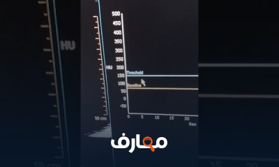 فحص اشعة مقطعية على القلب للمبتدئين