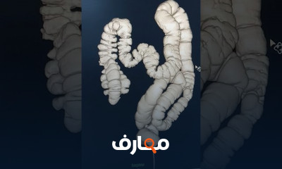 مفاهيم التصوير بالأشعة المقطعية