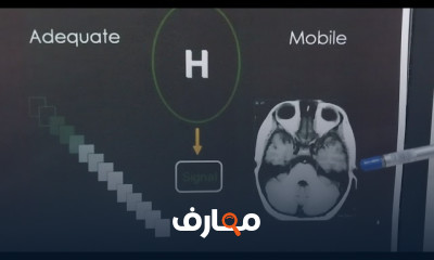 الفيزياء وخصائص التصوير بالأشعة الرنين المغناطيسي والأشعة المقطعية