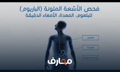 اشعة الصبغة