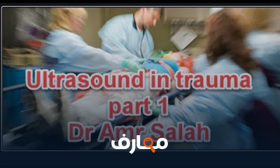 سونار الطواريء E fast ultrasouسونار الطواريءnd