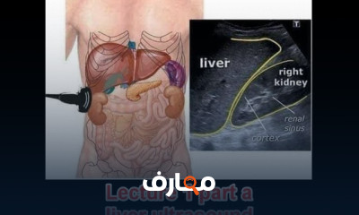 سونار البطن من البداية الى الاحتراف