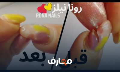 إصلاح الأظافر المكسورة
