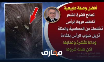 علاج قشرة الشعر الطبيعي