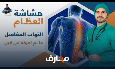 موسوعة العظام والمفاصل