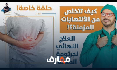 علاج جرثومة المعدة والنهائي