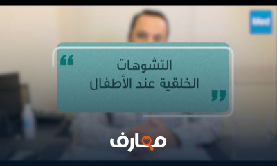 التشوهات الخلقية عند الأطفال