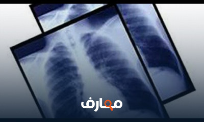 اعاده تدوير ورق الاشعه