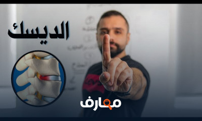 تمارين لعلاج الديسك الضاغط على العصب