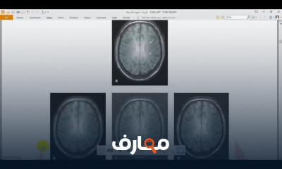 تقنيات أجهزة الأشعة الطبية