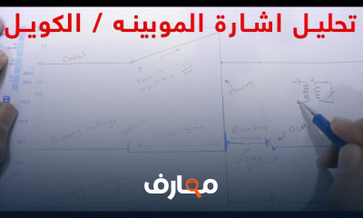 تحليل الإشارات الكهربائية