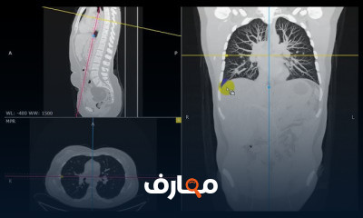 RadiAnt Dicom Viewer عرض الأشعات
