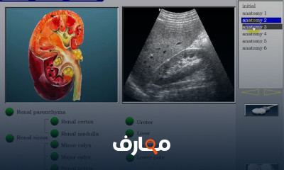 Kidney Ultrasound سونار الكلى