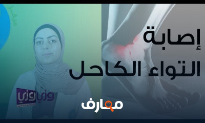 علاج طبيعي علاج طبيعي