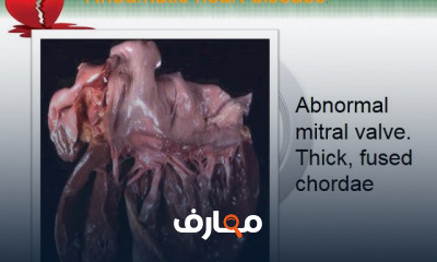 كلينيكال مستوى خامس