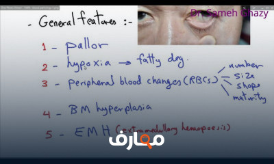 أمراض الدم والأنسجة الليمفاوية blood and lymphoreticular tissue pathology