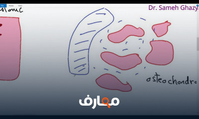 علم أمراض العظام bone pathology