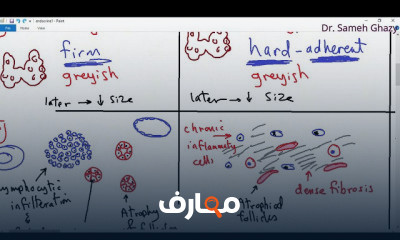 علم أمراض الغدد الصماء endocrine pathology