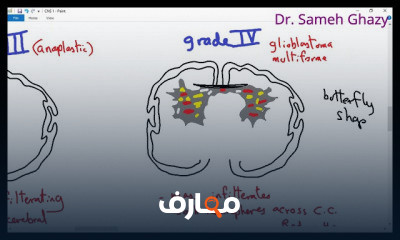 علم أمراض الجهاز العصبي المركزي CNS pathology