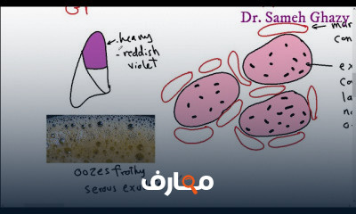أمراض الجهاز التنفسي respiratory system pathology