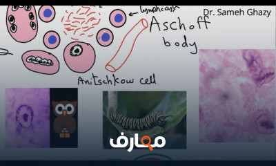 أمراض القلب والأوعية الدموية 2020 cardiovascular pathology