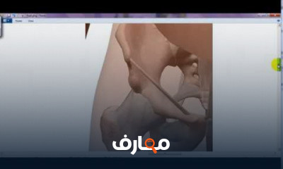 التشريح التطبيقي والسطحى lower limb applied and surface anatomy