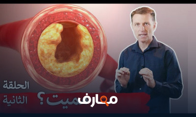 الكولسترول