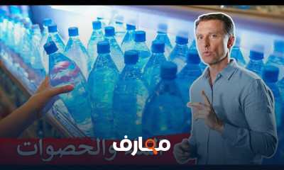 حصى الكلى
