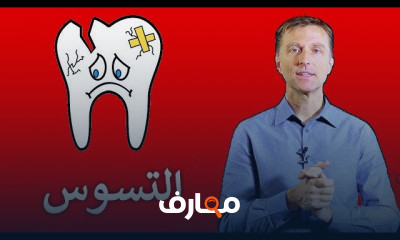 تسوس وألم الأسنان