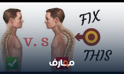 مشاكل العمود الفقرى وعلاجها