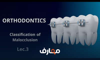 أساسيات تقويم الأسنان