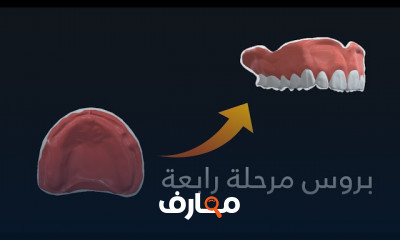 أساسيات صناعة الأسنان