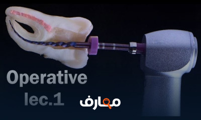 ترميم الأسنان