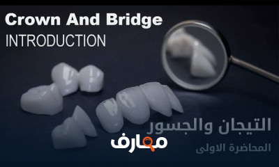 التيجان والجسور في طب الأسنان