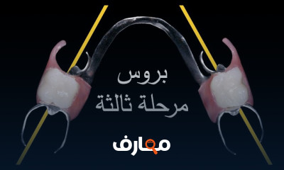 تقنيات صناعة اسنان