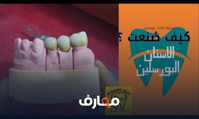 صناعة الأسنان البورسلين