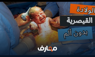 الولادة بدون ألم بالخطوات