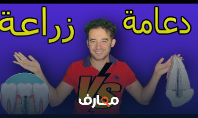 علاج الضروس والأسنان المتآكلة