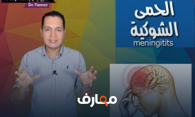 أسباب التهاب العصب السابع أسباب التهاب العصب السابع