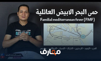 علاج الذئبة الحمراء فى الحمل