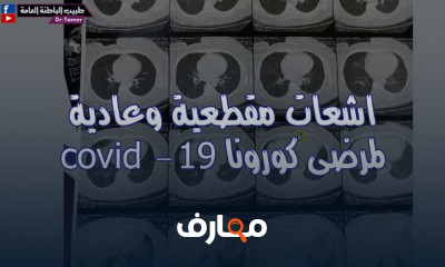 قراءة تحليل صورة الدم الكاملة