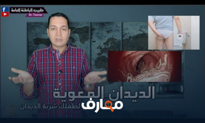 علاج الأميبا المتحوصلة