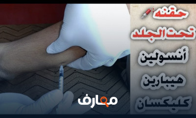 طريقه عمل اختبار الحساسية