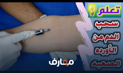 طريقة إعطاء الحقن الوريدية