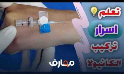 كيفيه تركيب الكانيولا