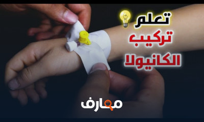 طريقة إجراء اختبار حساسية الحقن