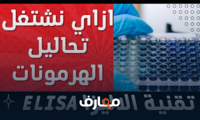 قياس هرمونات الغدة الدرقية