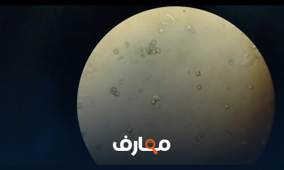 كيفية قراءة تحليل البول