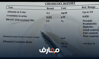 طريقة قياس السكر التراكمي